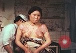 Image of burn wounds from atomic bomb Hiroshima Japan, 1946, second 44 stock footage video 65675060683