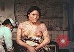Image of burn wounds from atomic bomb Hiroshima Japan, 1946, second 45 stock footage video 65675060683