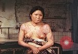 Image of burn wounds from atomic bomb Hiroshima Japan, 1946, second 47 stock footage video 65675060683