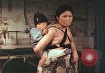 Image of burn wounds from atomic bomb Hiroshima Japan, 1946, second 48 stock footage video 65675060683