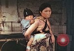 Image of burn wounds from atomic bomb Hiroshima Japan, 1946, second 49 stock footage video 65675060683