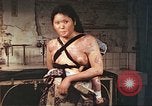 Image of burn wounds from atomic bomb Hiroshima Japan, 1946, second 51 stock footage video 65675060683