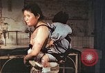Image of burn wounds from atomic bomb Hiroshima Japan, 1946, second 52 stock footage video 65675060683