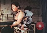Image of burn wounds from atomic bomb Hiroshima Japan, 1946, second 53 stock footage video 65675060683