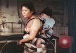 Image of burn wounds from atomic bomb Hiroshima Japan, 1946, second 55 stock footage video 65675060683