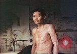 Image of atomic bomb victims receive care Hiroshima Japan, 1946, second 3 stock footage video 65675060684