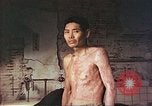 Image of atomic bomb victims receive care Hiroshima Japan, 1946, second 4 stock footage video 65675060684
