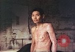 Image of atomic bomb victims receive care Hiroshima Japan, 1946, second 5 stock footage video 65675060684