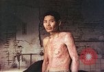 Image of atomic bomb victims receive care Hiroshima Japan, 1946, second 6 stock footage video 65675060684
