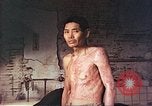 Image of atomic bomb victims receive care Hiroshima Japan, 1946, second 7 stock footage video 65675060684