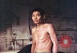 Image of atomic bomb victims receive care Hiroshima Japan, 1946, second 8 stock footage video 65675060684