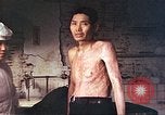 Image of atomic bomb victims receive care Hiroshima Japan, 1946, second 9 stock footage video 65675060684