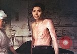 Image of atomic bomb victims receive care Hiroshima Japan, 1946, second 10 stock footage video 65675060684