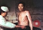 Image of atomic bomb victims receive care Hiroshima Japan, 1946, second 11 stock footage video 65675060684