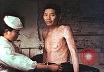 Image of atomic bomb victims receive care Hiroshima Japan, 1946, second 12 stock footage video 65675060684