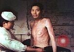 Image of atomic bomb victims receive care Hiroshima Japan, 1946, second 14 stock footage video 65675060684