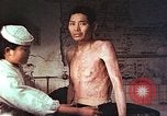 Image of atomic bomb victims receive care Hiroshima Japan, 1946, second 15 stock footage video 65675060684