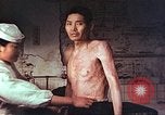 Image of atomic bomb victims receive care Hiroshima Japan, 1946, second 16 stock footage video 65675060684