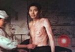 Image of atomic bomb victims receive care Hiroshima Japan, 1946, second 17 stock footage video 65675060684