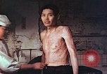 Image of atomic bomb victims receive care Hiroshima Japan, 1946, second 18 stock footage video 65675060684