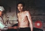 Image of atomic bomb victims receive care Hiroshima Japan, 1946, second 19 stock footage video 65675060684