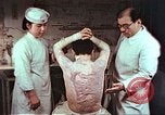 Standbild japanischen Atombombe Opfer Pflege Hiroshima Japan, 1946, aus Sekunde 24 historischem Filmmaterial Videoclip 65675060685