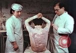 Standbild japanischen Atombombe Opfer Pflege Hiroshima Japan, 1946, aus Sekunde 25 historischem Filmmaterial Videoclip 65675060685