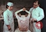 Standbild japanischen Atombombe Opfer Pflege Hiroshima Japan, 1946, aus Sekunde 28 historischem Filmmaterial Videoclip 65675060685