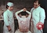 Standbild japanischen Atombombe Opfer Pflege Hiroshima Japan, 1946, aus Sekunde 29 historischem Filmmaterial Videoclip 65675060685