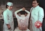 Standbild japanischen Atombombe Opfer Pflege Hiroshima Japan, 1946, aus Sekunde 30 historischem Filmmaterial Videoclip 65675060685