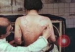 Standbild Burns auf der Rückseite der Atombombe Opfer Hiroshima Japan, 1946, aus Sekunde 10 historischem Filmmaterial Videoclip 65675060687