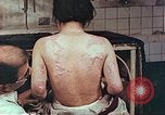Standbild Burns auf der Rückseite der Atombombe Opfer Hiroshima Japan, 1946, aus Sekunde 11 historischem Filmmaterial Videoclip 65675060687