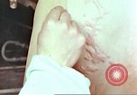 Standbild Burns auf der Rückseite der Atombombe Opfer Hiroshima Japan, 1946, aus Sekunde 22 historischem Filmmaterial Videoclip 65675060687