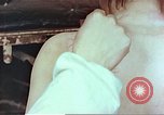 Standbild Burns auf der Rückseite der Atombombe Opfer Hiroshima Japan, 1946, aus Sekunde 24 historischem Filmmaterial Videoclip 65675060687