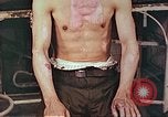 Image of burns on atomic bomb victims Hiroshima Japan, 1946, second 6 stock footage video 65675060688