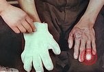 Image of burns on atomic bomb victims Hiroshima Japan, 1946, second 23 stock footage video 65675060688
