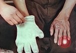 Image of burns on atomic bomb victims Hiroshima Japan, 1946, second 24 stock footage video 65675060688