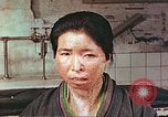 Image facial les blessures d'bombe atomique Hiroshima au Japon, 1946, de la seconde 3 séquences d'archives historiques vidéo 65675060689