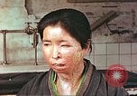 Image facial les blessures d'bombe atomique Hiroshima au Japon, 1946, de la seconde 5 séquences d'archives historiques vidéo 65675060689