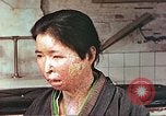 Image facial les blessures d'bombe atomique Hiroshima au Japon, 1946, de la seconde 7 séquences d'archives historiques vidéo 65675060689