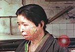 Image facial les blessures d'bombe atomique Hiroshima au Japon, 1946, de la seconde 8 séquences d'archives historiques vidéo 65675060689