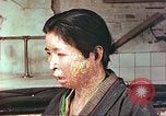 Image facial les blessures d'bombe atomique Hiroshima au Japon, 1946, de la seconde 9 séquences d'archives historiques vidéo 65675060689