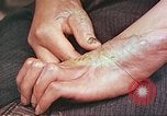 Image of medical care for atomic bomb victim Hiroshima Japan, 1946, second 3 stock footage video 65675060690