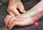 Image of medical care for atomic bomb victim Hiroshima Japan, 1946, second 4 stock footage video 65675060690