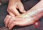 Image of medical care for atomic bomb victim Hiroshima Japan, 1946, second 6 stock footage video 65675060690