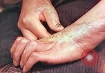 Image of medical care for atomic bomb victim Hiroshima Japan, 1946, second 7 stock footage video 65675060690
