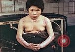 Image of medical care for atomic bomb victim Hiroshima Japan, 1946, second 8 stock footage video 65675060690