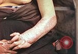 Image of medical care for atomic bomb victim Hiroshima Japan, 1946, second 14 stock footage video 65675060690