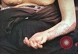 Image of medical care for atomic bomb victim Hiroshima Japan, 1946, second 23 stock footage video 65675060690