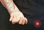 Image of medical care for atomic bomb victim Hiroshima Japan, 1946, second 32 stock footage video 65675060690